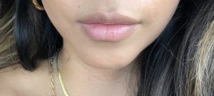 Slate MedSpa Lips, Slate Med Spa: Let’s talk about Lips!, Sandy Wears It