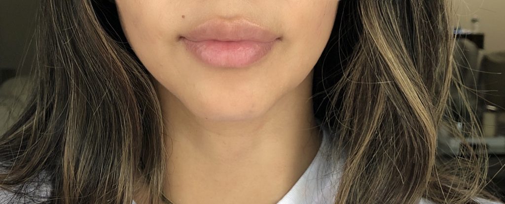 Slate MedSpa Lips, Slate Med Spa: Let’s talk about Lips!, Sandy Wears It